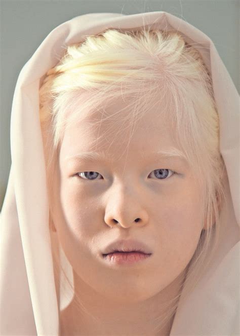 Albino Albino Model Beauty Interesting Faces