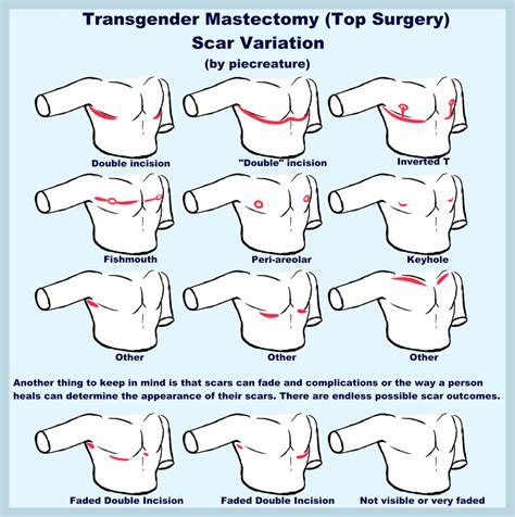 Top Surgery Scars By Piecreature On Deviantart