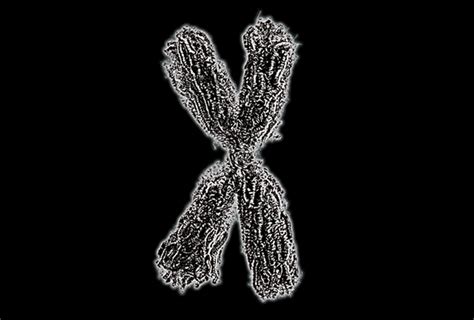 X Chromosome Variants Help Explain Autisms Sex Bias Spectrum