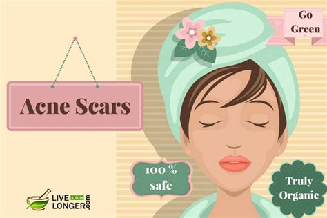 Home remedies, treatments and natural cures for acne scars are quite effective in lightening and gradual removal of the scars. 5 True & Tried Home Remedies For Acne Scars