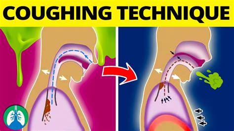 This Coughing Technique Can Help Get Rid Of Mucus And Phlegm Youtube