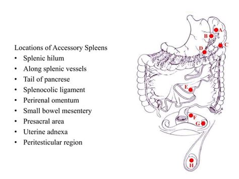 Splenectomy By Dr M Shehu Ppt