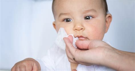 Quais são os Sinais de uma Alergia Alimentar em Bebês