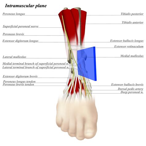 Ankle Anterior Approach Approaches Orthobullets