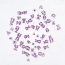 Human Chromosome Microscope Slides Carolina Biological Supply