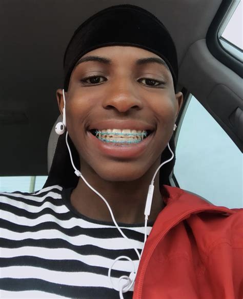 Braces Color Ideas For Dark Skin Kimi Odell