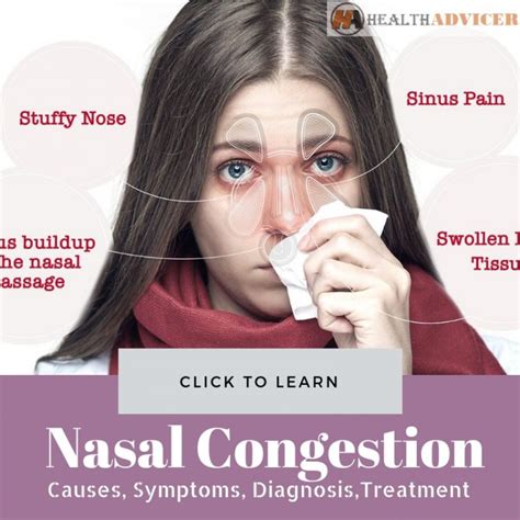 Nasal Congestion Causes Picture Symptoms And Treatment
