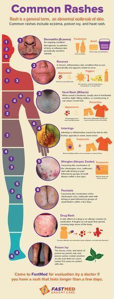 Common Rashes Infographic Skin Itch Rash Medical Education