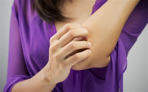 What Causes The Ringworm Rash Us Dermatology Partners