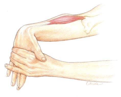 ‘tennis Elbow 5 Tips For Relieving That Outer Elbow Pain Also Known