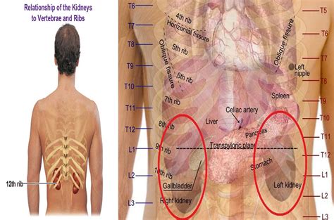 Kidney Pain Location Pictures Symptoms Causes Diagnosis