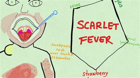Scarlet Fever Visual Mnemonic Youtube