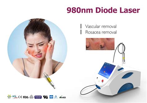 980nm Diode Laser Treatment Spider Vein Removal Therapy Beijing Starlight Sandt Development