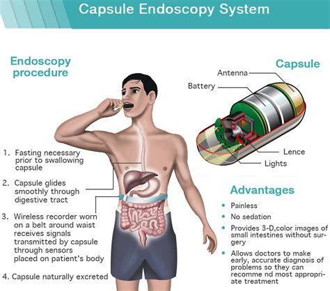 Endoscopy Prep Risks And Endoscopy Procedure