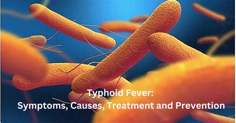 Typhoid Fever Symptoms Causes Treatment And Prevention
