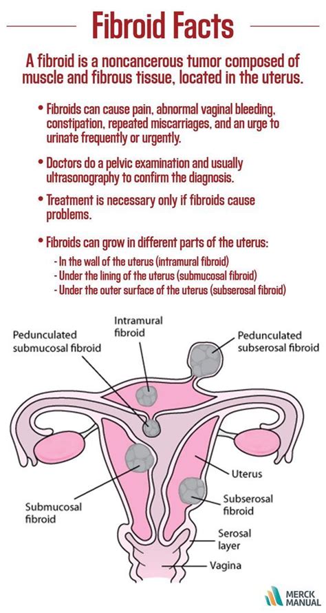 Fibroid Tumor Size Chart