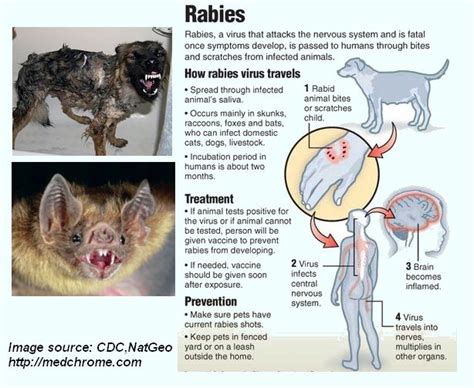 Rabies Facts Features And Management Guidelines Medchrome