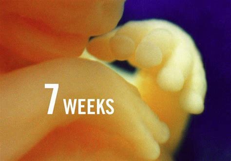 Photo Of An Unborn Child At 7 Weeks Fetal Development Pinterest