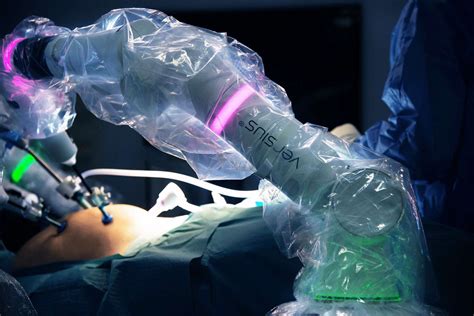 1000 Operations Completed With Cmr Surgicals Versius Robot