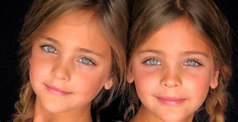 Identical Twins Were Born In 2010 Now Theyre Dubbed The Most 2e6