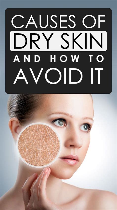 Causes Of Dry Skin And How To Avoid It Artofit