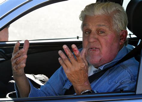Jay Leno Spotted Driving Into Same Garage As Car Fire