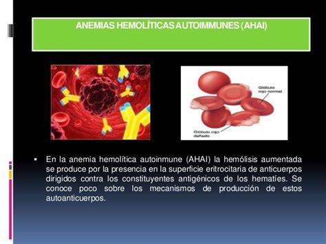Anemia Hemolitica Adquirida Expo Terminada