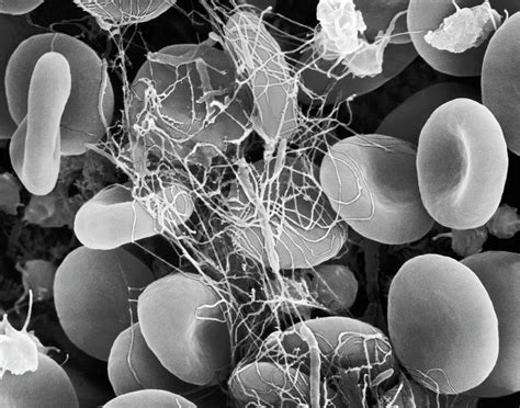 Red Blood Cells Trapped In A Fibrin Blood Clot Photograph By Dennis