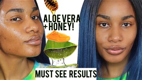 Aloe vera and honey face mask can benefit your skin in many ways. I used Fresh Aloe Vera + Honey on My Face for 5 DAYS| Got ...