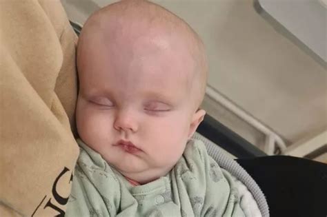 Baby Diagnosed With Brain Tumour After Mum Notices Unusual Symptoms