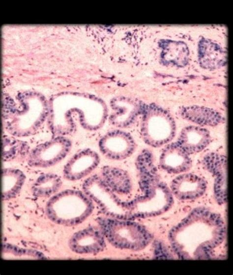 Solved Apocrine Sweat Gland Low Magnification Identify