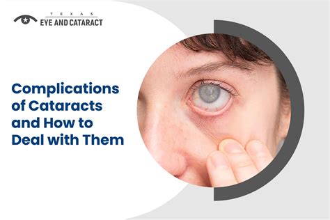 Complications Of Cataracts And How To Deal With Them