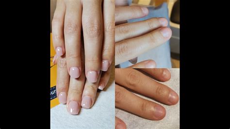 Fix Veryshort Bitten Nails With Acrylic Cndshort Nails Transformations