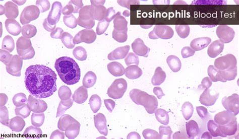 Eosinophils Blood Test Procedure Causes Of Eosinophilia And Treatment