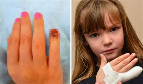 Girl Left Without Tip Of Babe Finger After It Was SLICED OFF UK News Express Co Uk
