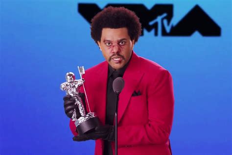 The Weeknd Shows Off Dramatic Plastic Surgery Enhanced Face For ‘save