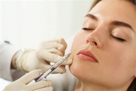 12 Things You Need To Know About Long Lasting Radiesse Fillers
