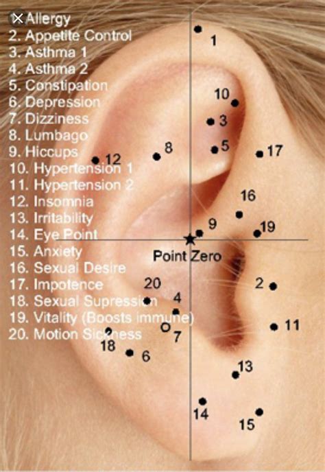 Ear Seeds Acupressure Points Chart