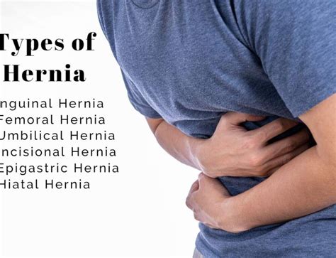 Umbilical Hernia Symptoms And Causes Dr Abhijit Gotkhinde