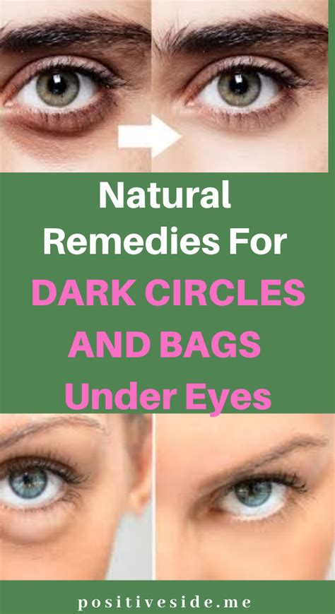 Natural Remedies For Dark Circles And Bags Under Eyes Dark Circle
