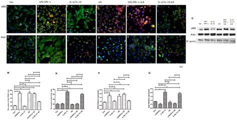 Inflammatory Factors And Amyloid β Induced Microglial Polarization