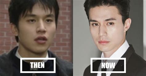 Here Is The Truth About Lee Dong Wooks Plastic Surgery Kpoplove