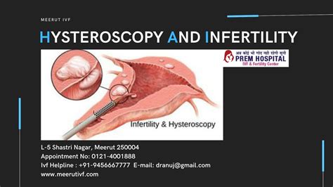 Pin On Hysteroscopy Surgery