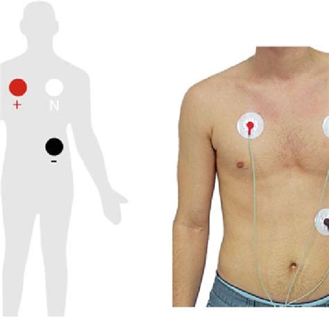 Ecg Electrode Placement Download Scientific Diagram