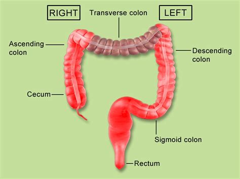 In american english, the first word after a colon is capitalized when it begins a new sentence and when it's a proper noun or acronym. Big Difference in Colorectal Cancer on Right vs Left Side