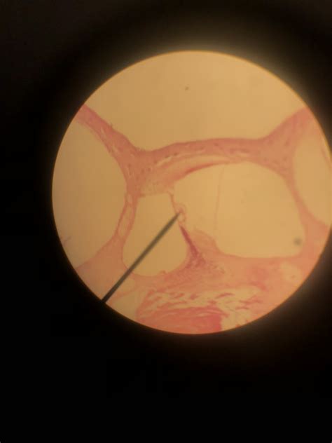 Cochlea Microscope Slide Diagram Quizlet
