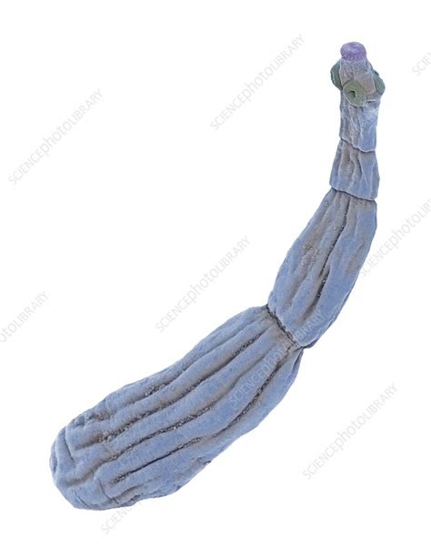Dog Tapeworm Sem Stock Image C0169038 Science Photo Library