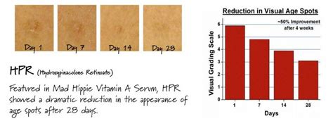 Acne Grading Scale