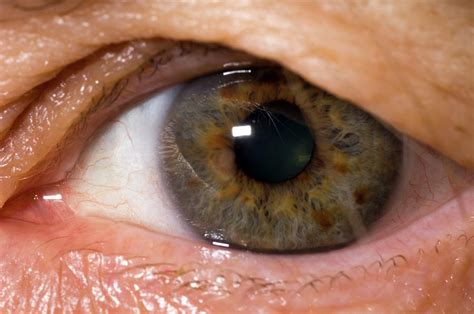 Pigmented Iris Photograph By Dr P Marazziscience Photo Library
