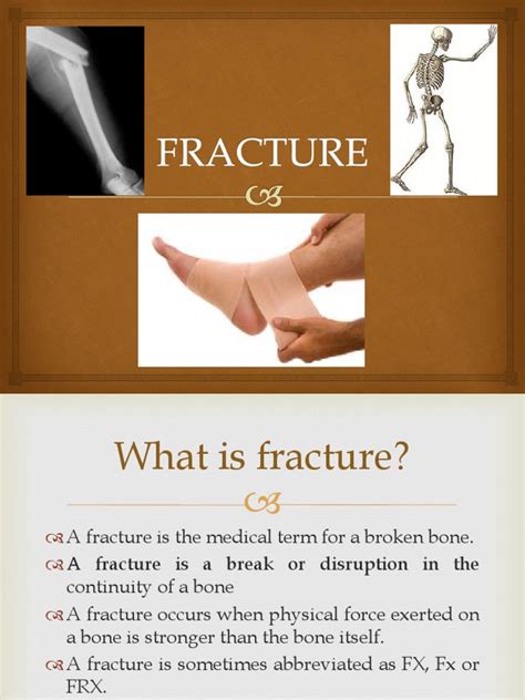 All About Fracture Pdf Bone Musculoskeletal System